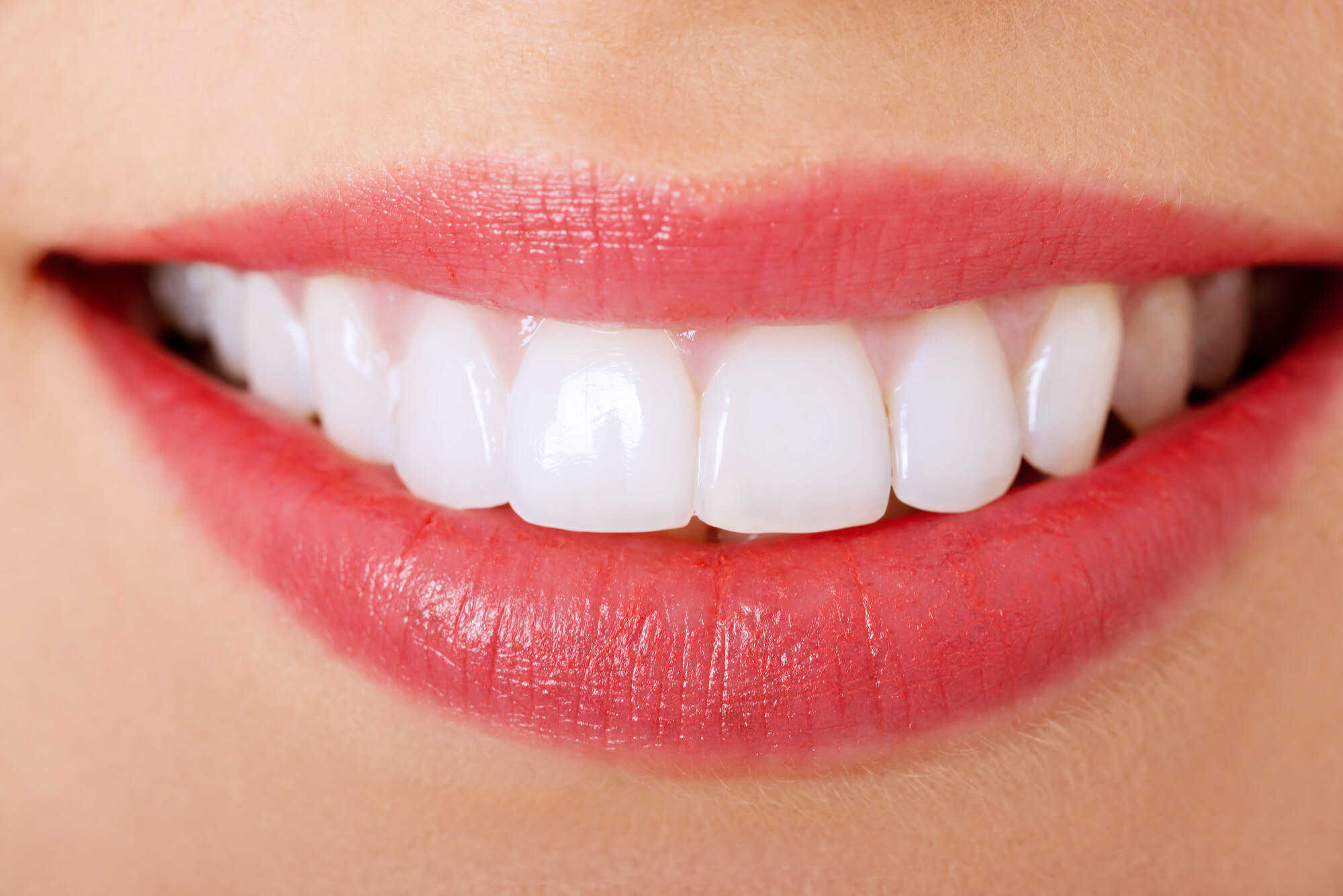 Teeth whitening in Cary NC