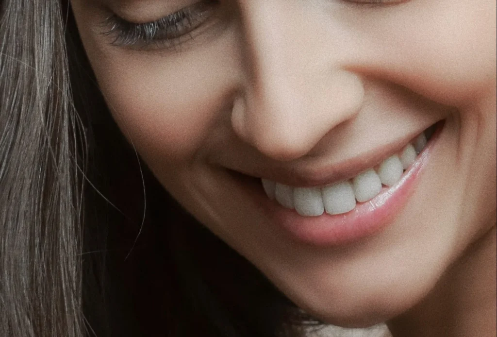 Dental Veneers