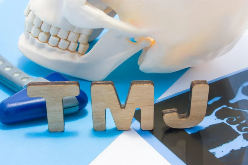 TMJ Disorders