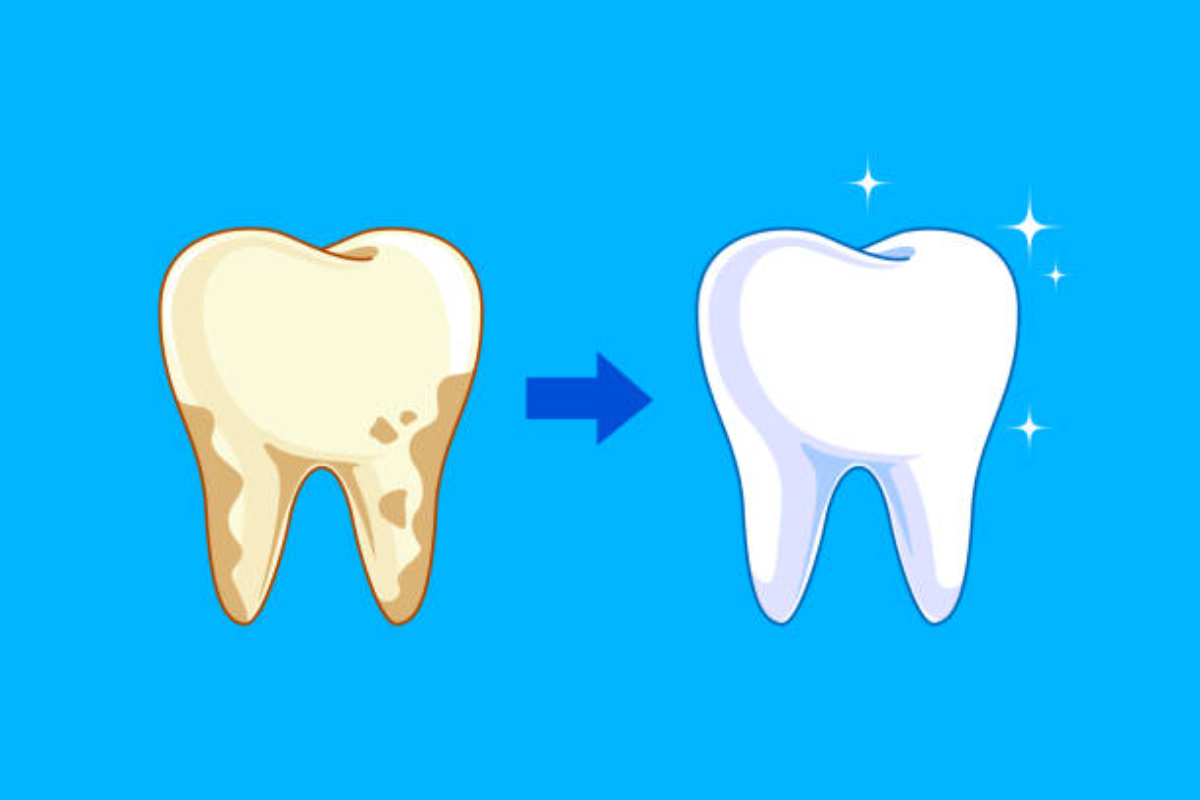 fix yellow teeth naturally