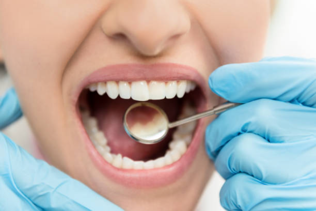 tooth filling for front teeth